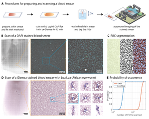 Graphical abstract for Octopi: Open configurable high-throughput imaging platform for infectious disease diagnosis in the field