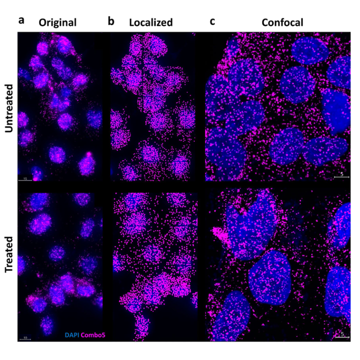 Graphical abstract for Graph-based spatial proximity of super-resolved protein–protein interactions predicts cancer drug responses in single cells